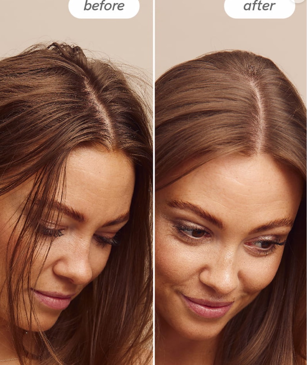 brosse cuir chevelu é